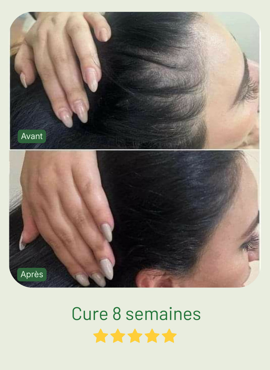 Elysia Roll On Booster®